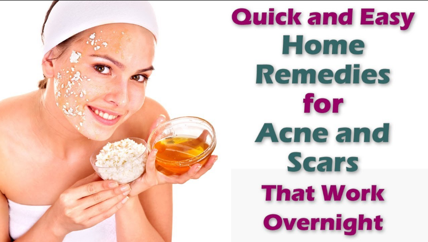 acne scar removal home remedies fast